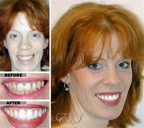 gum disease treatment near me|Gingivitis .